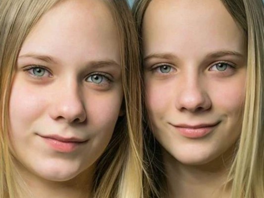 Hay un auge sin precedentes de gemelos en el mundo, según estudio