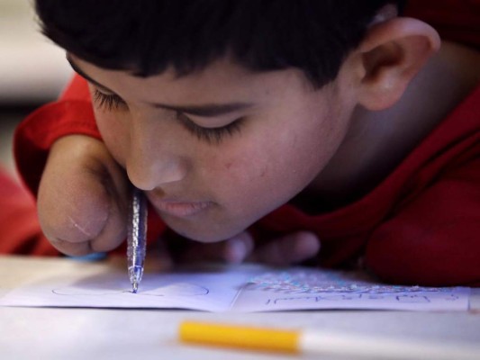 EEUU: Niño sirio sin brazos avanza, quiere reunir a familia