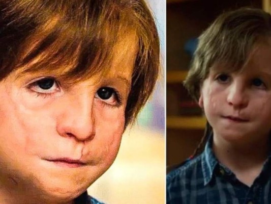 FOTOS: Así luce en la vida real el protagonista de Wonder