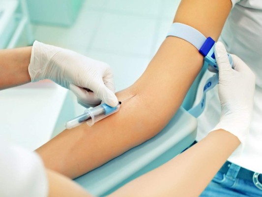 Los once síntomas que indican que tienes el colesterol alto