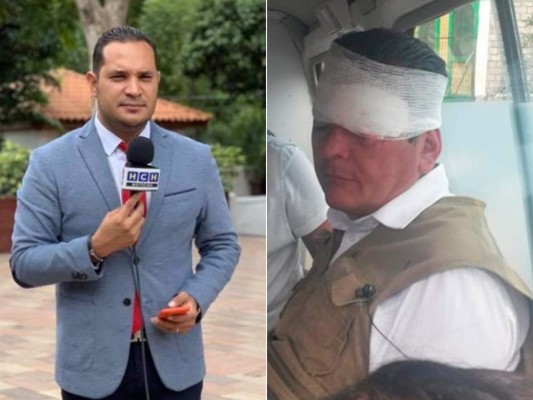 Tres masacres y agresiones en protestas, entre los hechos violentos que marcaron esta semana a Honduras