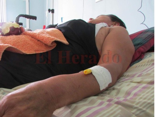 Secretaría de Salud indaga seis muertes por dengue grave en el país