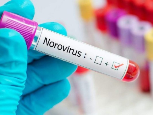 ¿Qué es Norovirus, la 'enfermedad del vómito' que registra brote en Reino Unido?&nbsp; &nbsp;&nbsp;