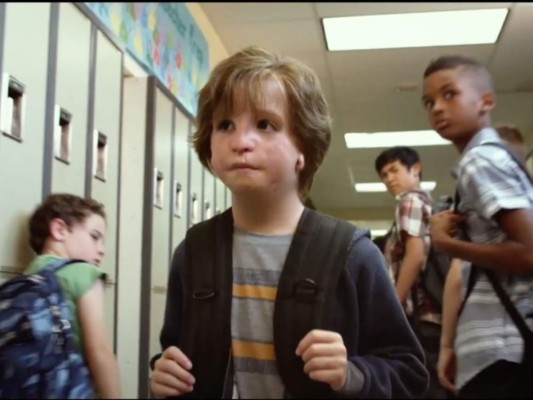 FOTOS: Así luce en la vida real el protagonista de Wonder