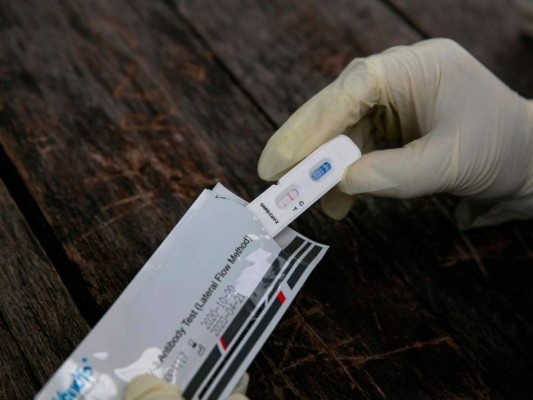 México presenta reducción en la curva del covid-19, según autoridades