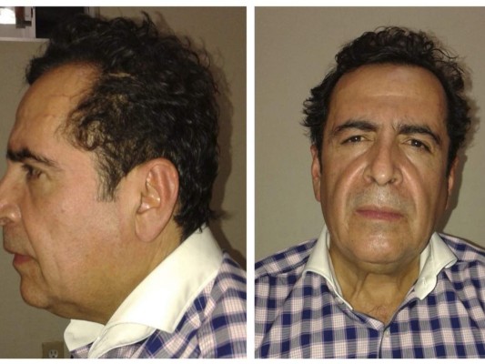Muere el narcotraficante Héctor Beltrán Leyva, alias 'El H'