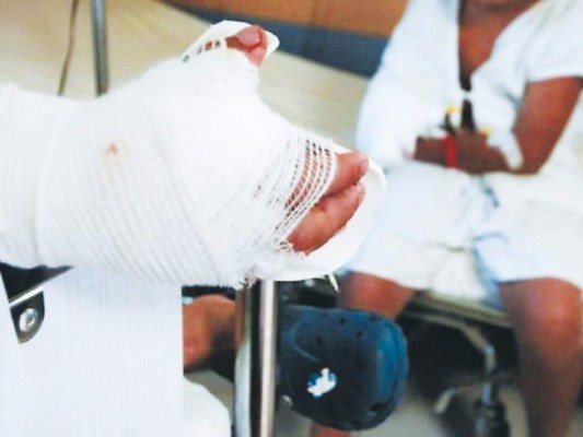 El 2018 cerró con 64 personas quemadas por utilizar pólvora