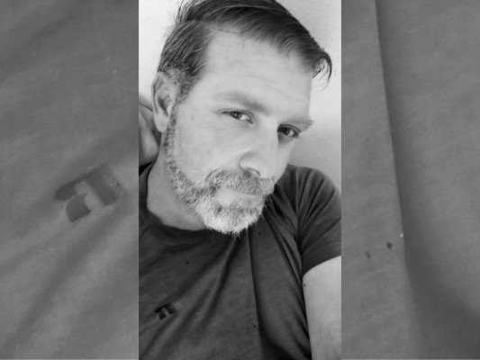 Desgarrador: así quedó el brazo de un trabajador de 'Rust' tras mordedura de araña venenosa