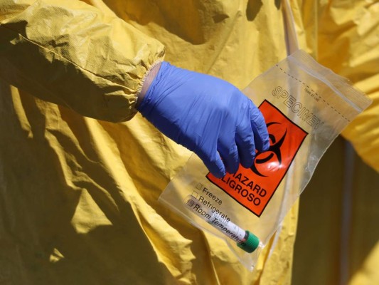 España registra un repunte de fallecimientos diarios por coronavirus