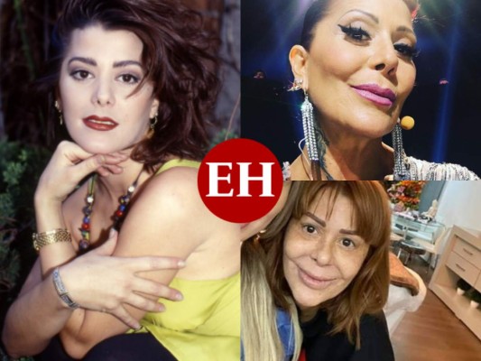 Alejandra Guzmán luce completamente irreconocible; su rostro ya no es el mismo