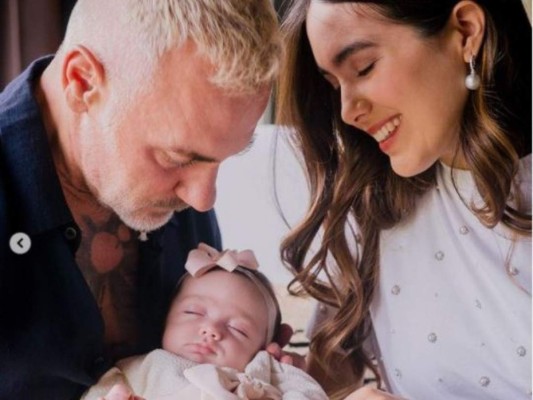 Blu, hija de Gianluca Vacchi y Sharon Fonseca, nació con paladar hendido