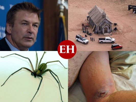 Desgarrador: así quedó el brazo de un trabajador de 'Rust' tras mordedura de araña venenosa