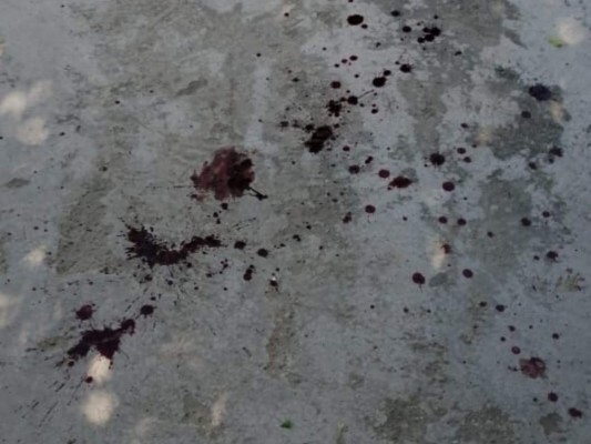 Balas, sangre y muertos: las fotos de la liberación de 'El Porky'