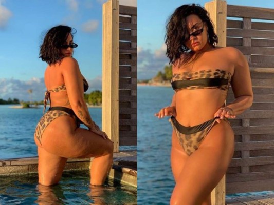 Famosas que mostraron sus estrías, celulitis y cicatrices en Instagram