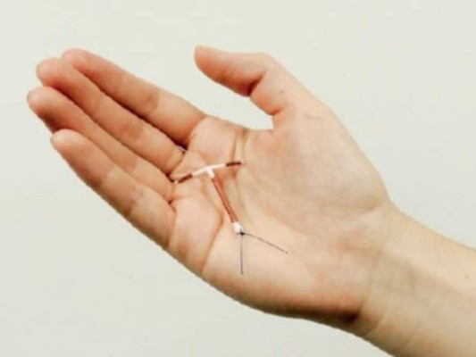 Estos son los beneficios de la 'T de cobre' como método anticonceptivo