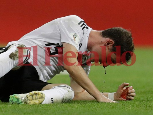 Alemania vs Suecia: Así fue la patada que Ola Toivonen le dio en la cara a Sebastián Rudy