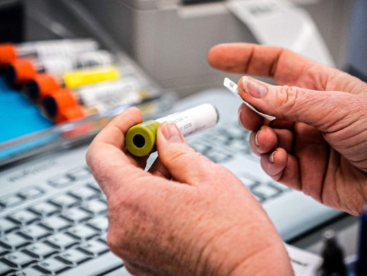 10 noticias alentadoras en la lucha contra epidemia de coronavirus