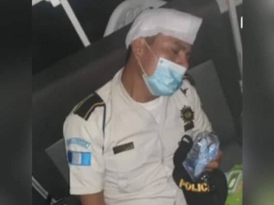 El Gobierno de Guatemala difundió algunas fotografías de agentes policiales heridos tras el enfrentamiento.