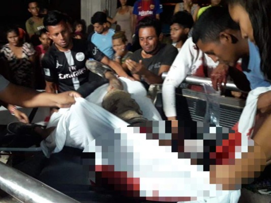 Hieren a machetazos a un joven en Guaimaca