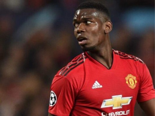 Pogba está impaciente por volver a jugar tras su lesión
