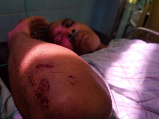 Muere obrero que había sido rescatado tras que lo soterrara un alud de tierra