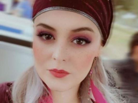 Allisson Lozz revela que podría quedar ciega a los 30 años