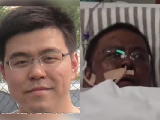 Muere médico chino al que el letal Covid-19 le oscureció la piel