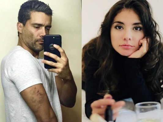 Alejandro García muestra las heridas que le provocó su exnovia Eileen Moreno