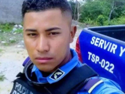 Muere policía hondureño que hace un mes resultó con quemaduras de gravedad