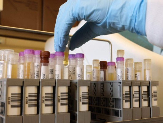 Novavax promete 1,100 millones de vacunas para programa Covax