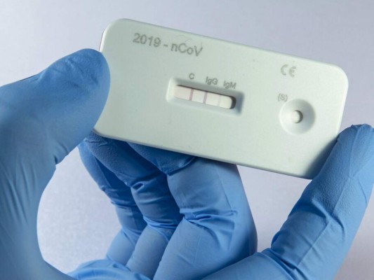 Francis Contreras: 'Con una prueba rápida saldremos a buscar pacientes”