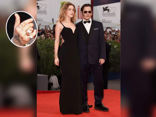 Borraron de su piel los amores del pasado plasmados en tatuajes