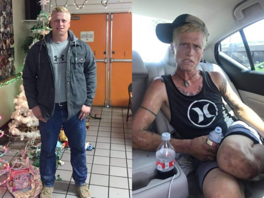 La cara de la heroína: Impactante antes y después de un joven adicto