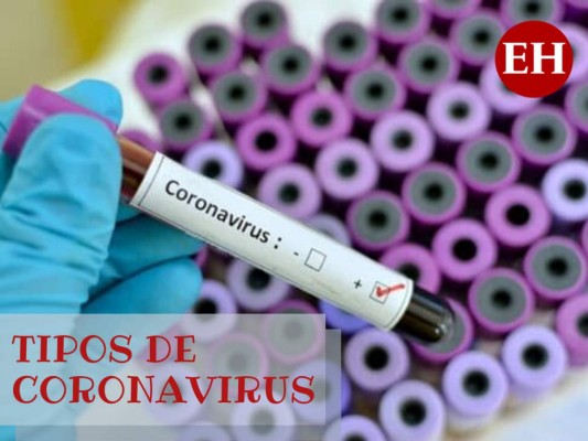 ¿Cuántos tipos de coronavirus hay capaces de generar epidemias?