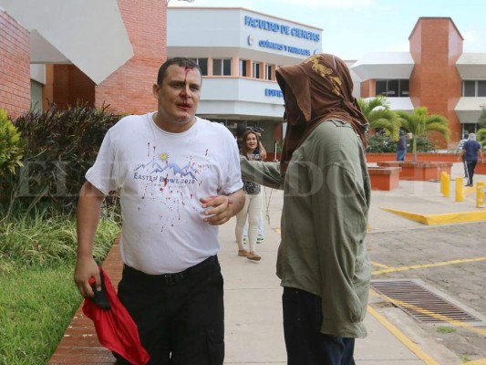 Al menos nueve heridos deja enfrentamiento en la UNAH