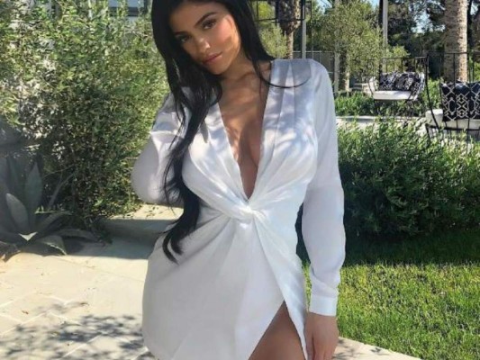 Kylie Jenner no podrá rellenarse los labios durante su embarazo