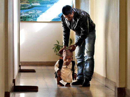 Muere el hombre más pequeño del mundo