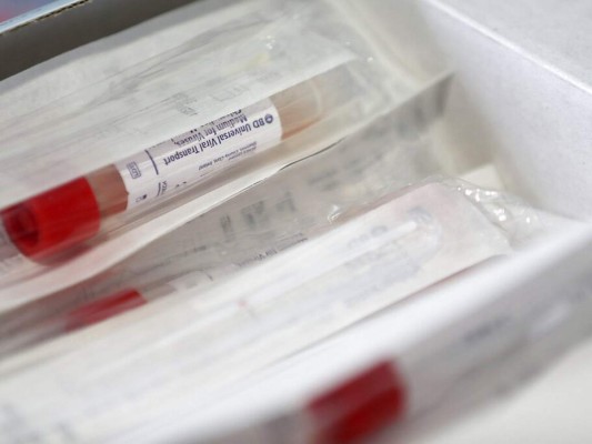 ¿Qué se sabe hasta ahora del coronavirus que ya dejó 10,000 muertos? 