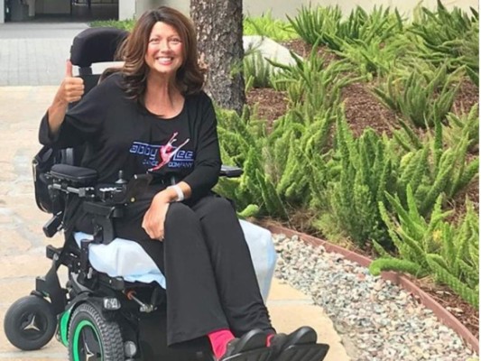 FOTOS: Los cambios físicos que sufrió Abby Lee Miller de 'Dance Moms' por su lucha contra el cáncer  