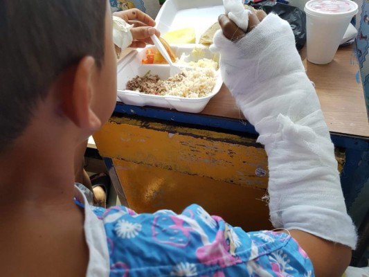 Once personas más resultan quemadas por pólvora en Honduras