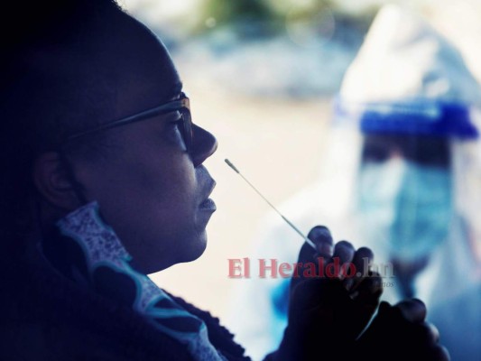 Honduras tiene déficit del 75% en aplicación de pruebas PCR para detectar Covid-19