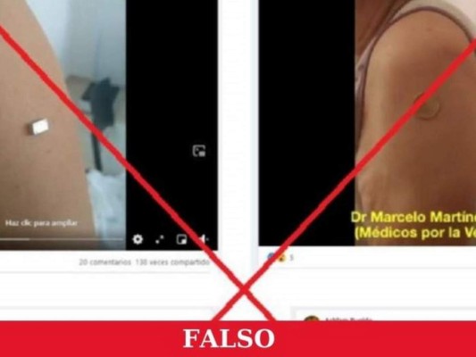 ¿Las vacunas contra el covid-19 generan atracción magnética?