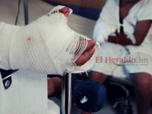 Fiestas de Navidad en Honduras dejaron unos once quemados por pólvora