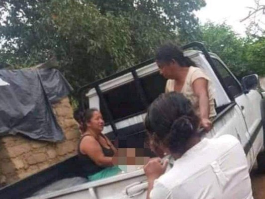 'Solo escuché el bombazo, lo agarré, pero ya estaba muerto”