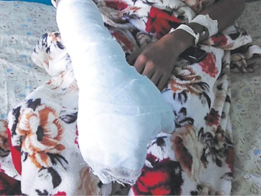 Dan alta a cinco niños quemados por pólvora