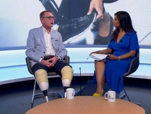 Perdió las piernas y parte de su rostro por un arañazo de su perro