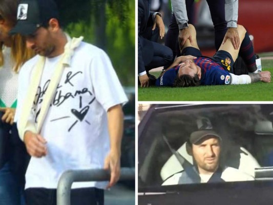 Revelan primeras imágenes de Leo Messi tras sufrir fractura en su brazo derecho