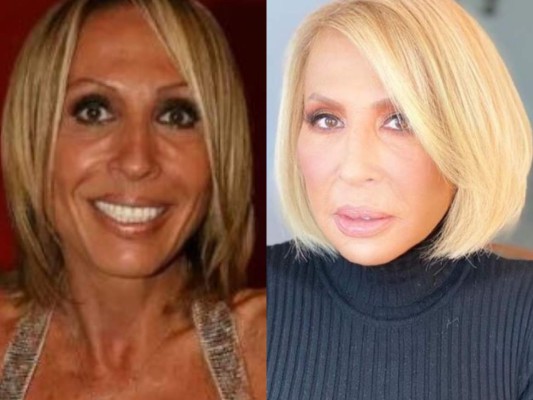 FOTOS: El cambio de Laura Bozzo tras destruir su cara con bótox