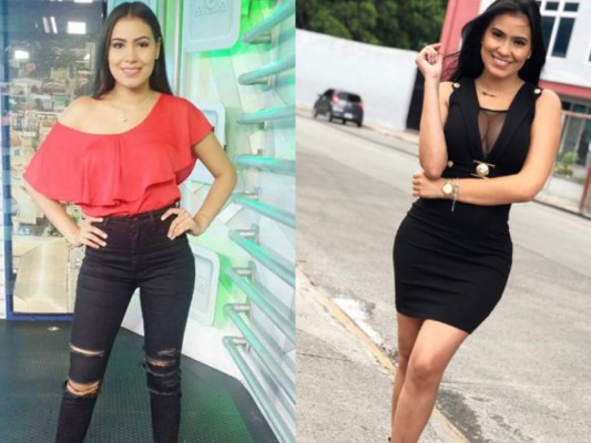 FOTOS: Así lucen estas conocidas hondureñas tras someterse a cirugías