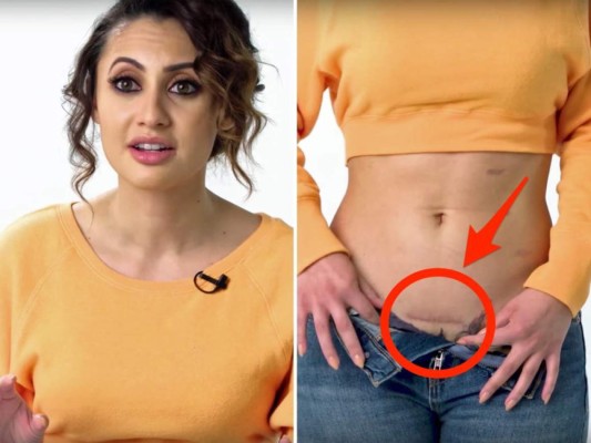 Francia Raisa sufrió depresión tras donarle a Selena Gómez un riñón; así es su cicatriz
